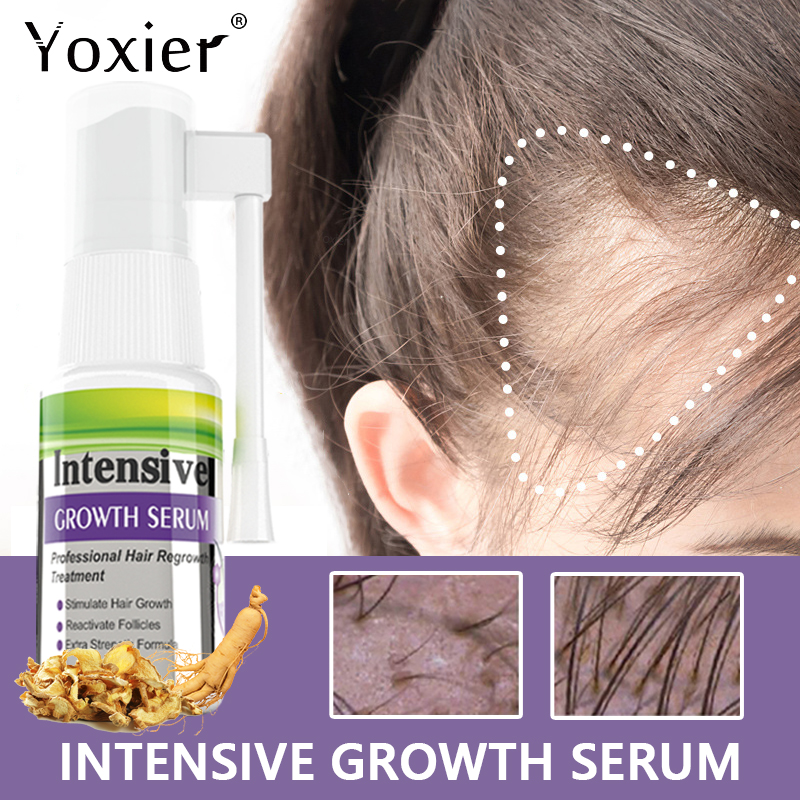 Hair Care For Hair Loss - Chuyên Sâu Serum Kích Kem Ngăn