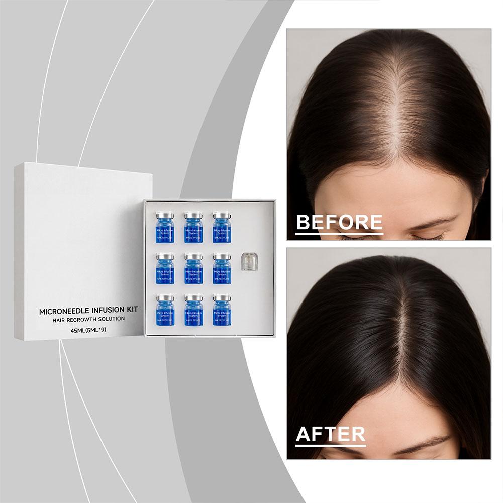 Hair Care Essence - 0.25mm Hair Essential Serum Micro-needle Roller