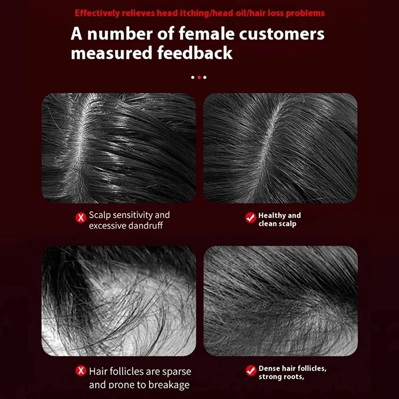 Electric Vibration Massage Com - đánh giá và giá Hair Care For Hair Loss