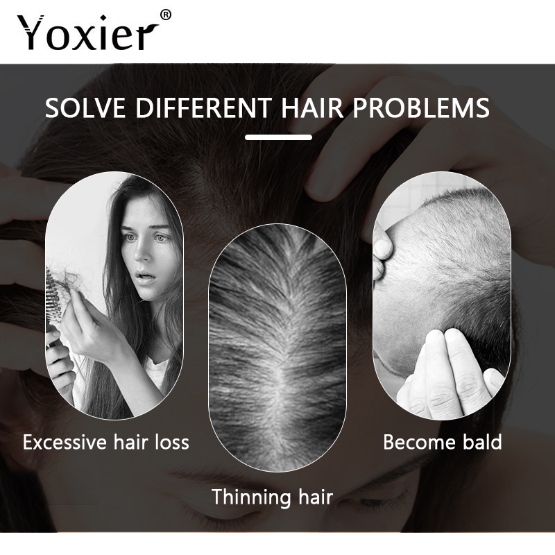 Chuyên Sâu Serum Kích Kem Ngăn - đánh giá và giá Hair Care For Hair Loss