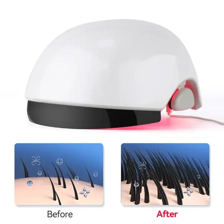 Red‑Light Hair Growth Helmet,  - đánh giá và giá Hair Care Lab