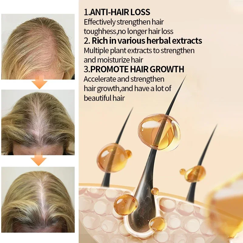 Ginger Fast Hair Growth Spray  - đánh giá và giá Hair Care Hair Serum