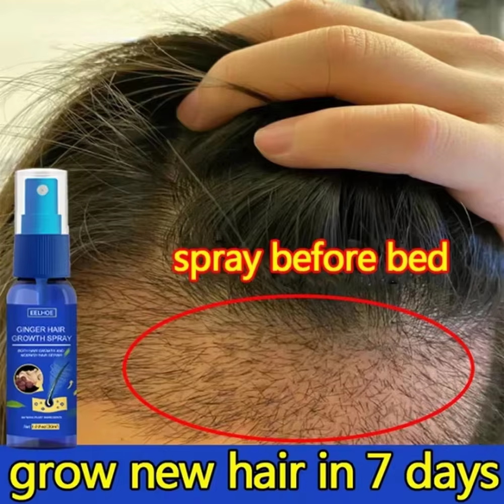 Fast Ginger Hair Growth Spray  - đánh giá và giá Hair Care For Hair Loss