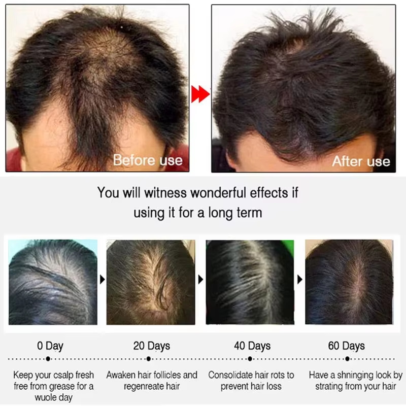 Fast Ginger Hair Growth Spray  - đánh giá và giá Hair Care For Hair Loss