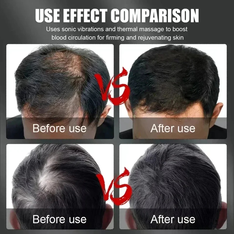 660nm 850nm Red Light Infrared - đánh giá và giá Hair Care For Hair Loss